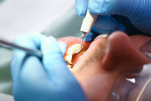 Best Emergency Dental Care for Abscessed Tooth in Camp Swift, TX