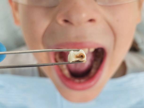 Best Mobile Emergency Dentist in Camp Swift, TX